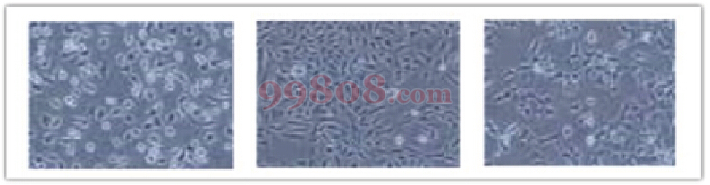 WHB细胞爬片培养下的细胞状态对比图